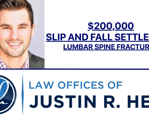Slip and Fall Settlement for Lumbar Spine Fractures