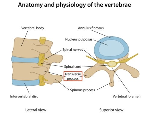Transverse Spine Fracture