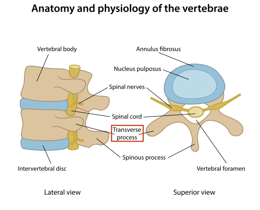 200,000 Settlement Spine Fracture in Slip and Fall Law Offices of Justin R. Heim